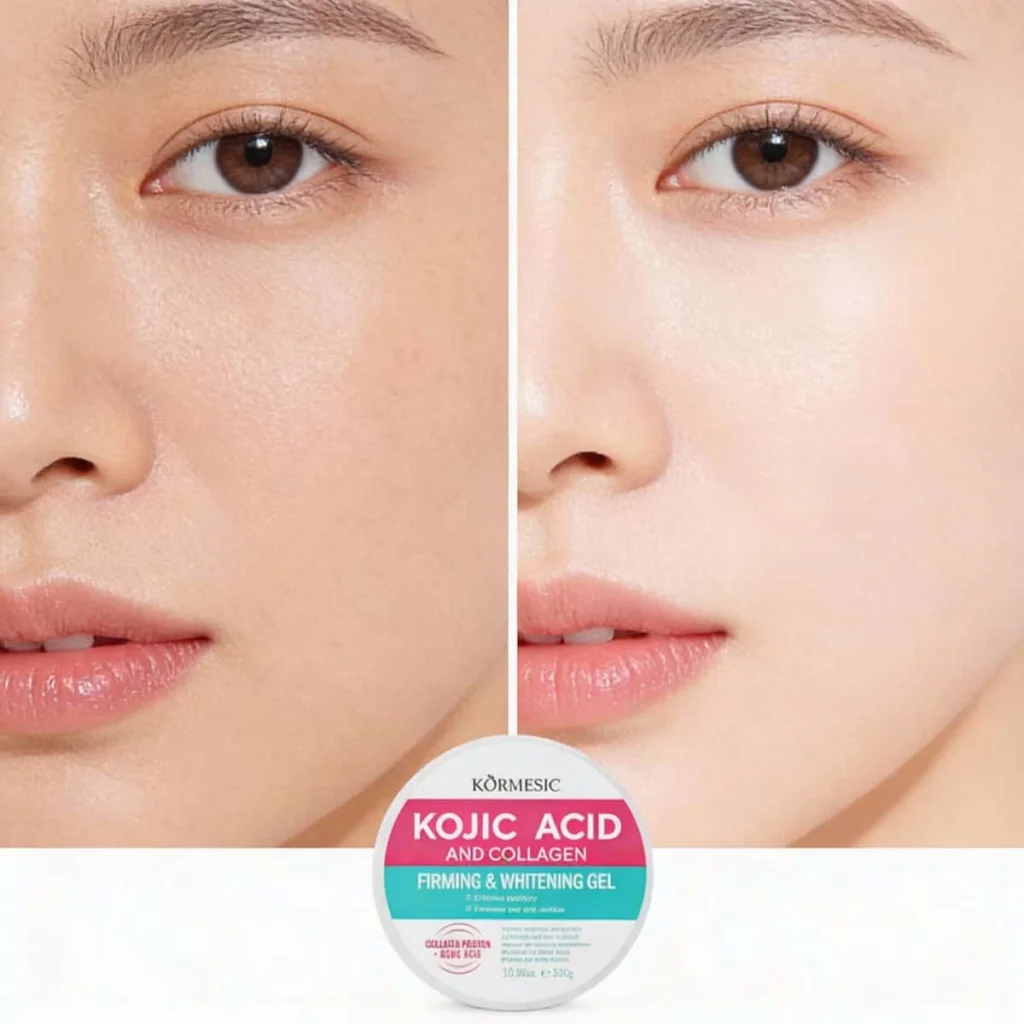 Gel cu acid kojic și colagen, Kormesic, 300g - imagine 4