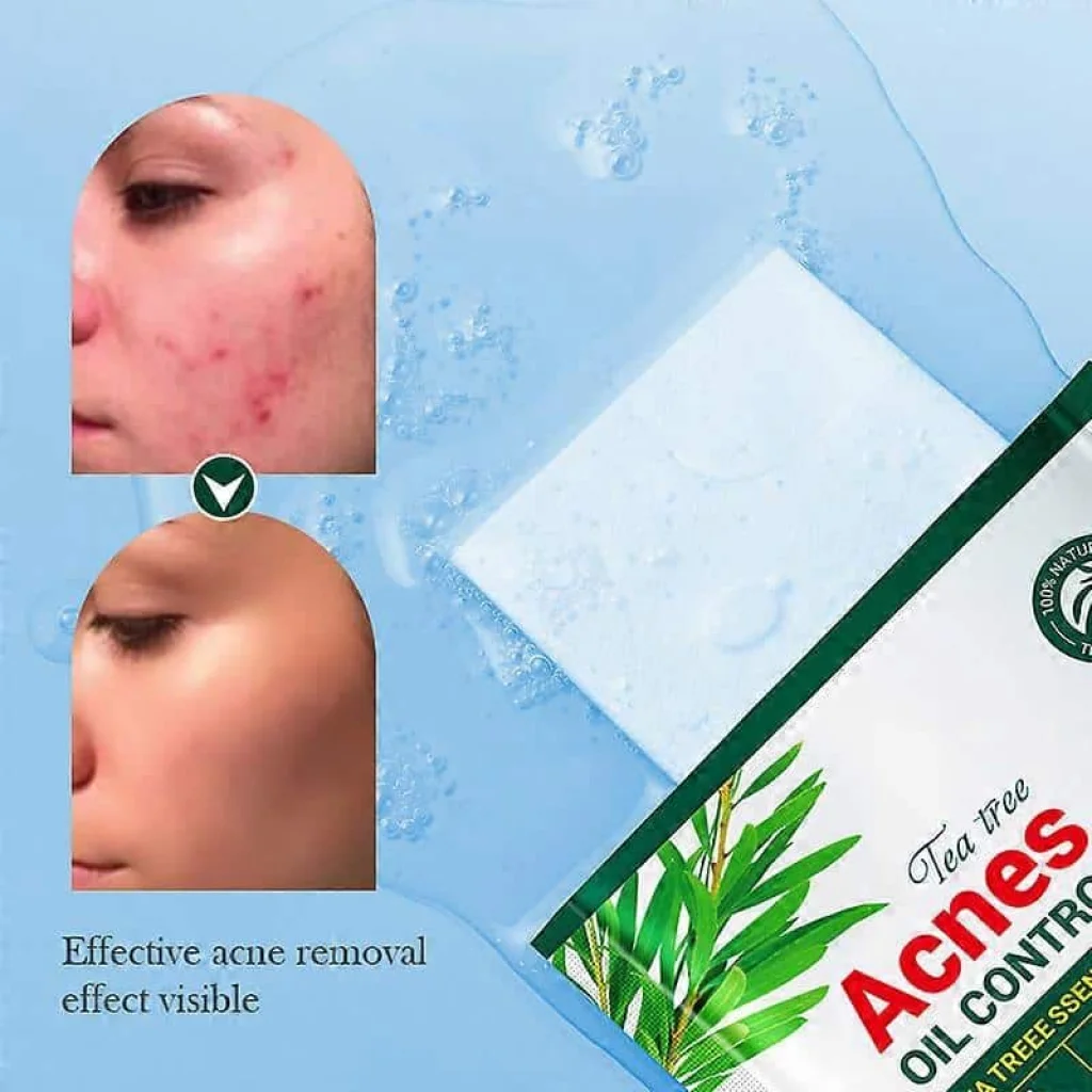 Mască facială anti acnee, cu extract de arbore de ceai - imagine 4